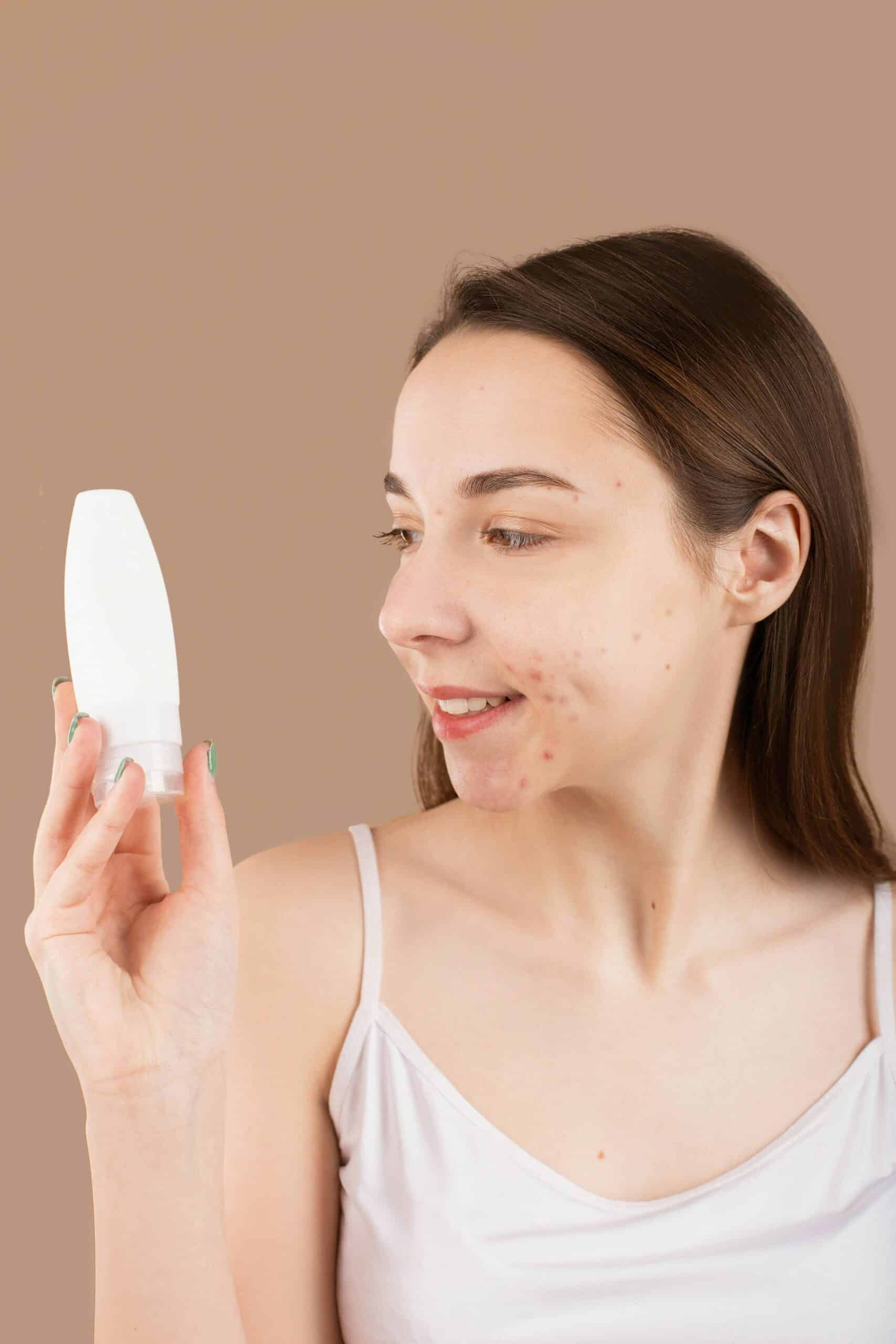 Smiling woman with acne holds a skincare product, highlighting facial care and treatment.