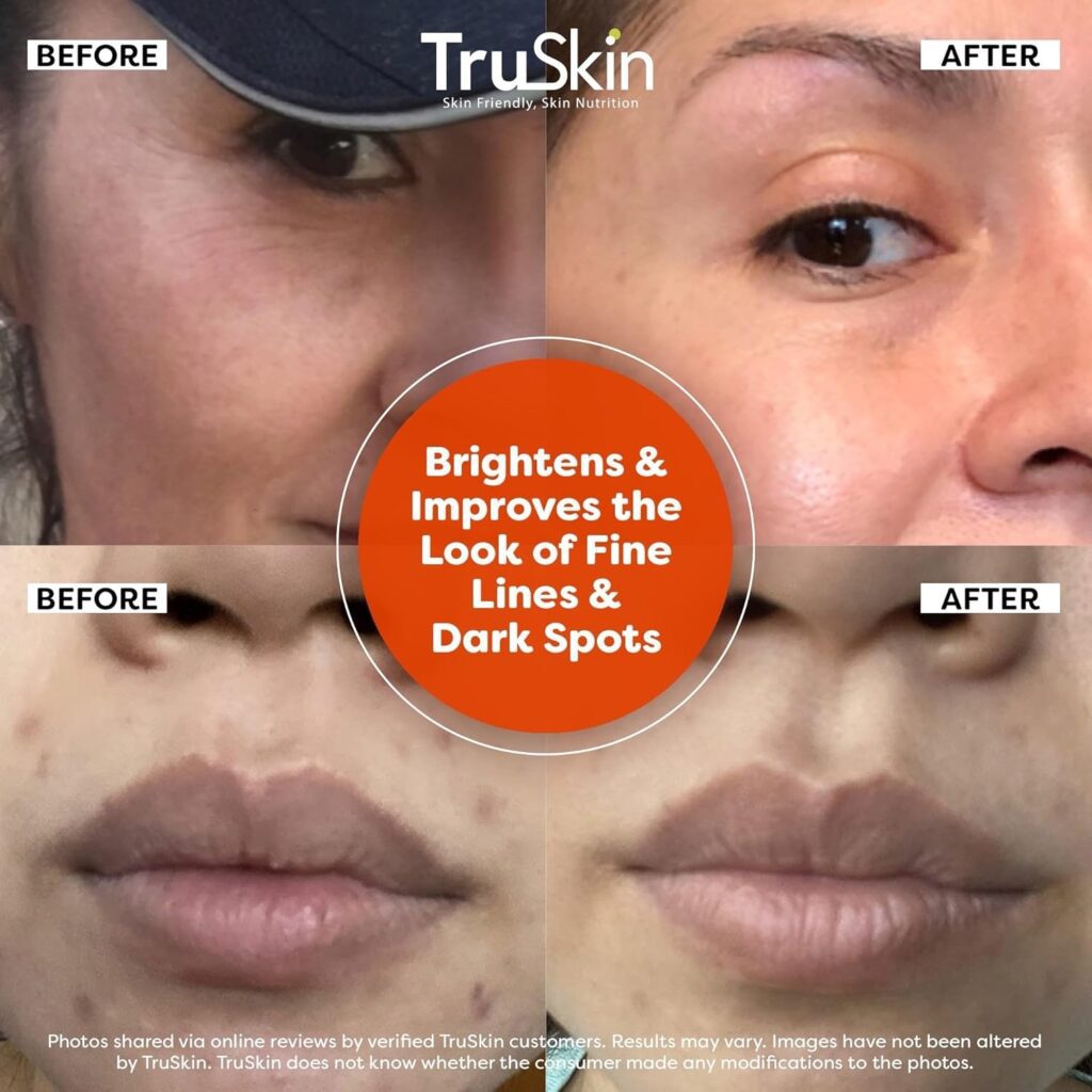 Serum For Face – Anti Aging Face Serum with Vitamin C, Hyaluronic Acid, Vitamin E – Brightening Formula – Improve Appearance of Dark Spots